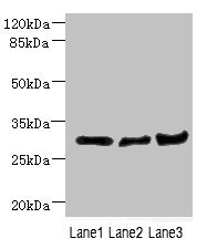 DCXR Antibody - Western blot All Lanes: DCXR antibody at 2.23ug/ml Lane 1: Mouse lung tissue Lane 2: Mouse liver tissue Lane 3: Mouse gonadal tissue Goat polyclonal to Rabbit IgG at 1/10000 dilution Predicted band size: 26 kDa Observed band size: 26 kDa