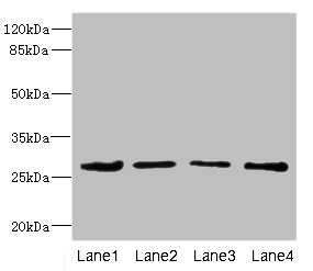 DCXR Antibody - Western blot All Lanes: DCXR antibody at 2.93ug/ml Lane 1: Mouse gonadal tissue Lane 2: HepG-2 whole cell lysate Lane 3: A431 whole cell lysate Lane 4: MCF7 whole cell lysate Goat polyclonal to Rabbit IgG at 1/10000 dilution Predicted band size: 26 kDa Observed band size: 26 kDa