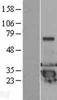 DCXR Protein - Western validation with an anti-DDK antibody * L: Control HEK293 lysate R: Over-expression lysate