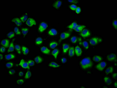 DCYTB / CYBRD1 Antibody - Immunofluorescence staining of Hela cells diluted at 1:200, counter-stained with DAPI. The cells were fixed in 4% formaldehyde, permeabilized using 0.2% Triton X-100 and blocked in 10% normal Goat Serum. The cells were then incubated with the antibody overnight at 4°C.The Secondary antibody was Alexa Fluor 488-congugated AffiniPure Goat Anti-Rabbit IgG (H+L).