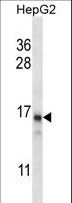 DDA1 Antibody - PCIA1 Antibody western blot of HepG2 cell line lysates (35 ug/lane). The PCIA1 antibody detected the PCIA1 protein (arrow).