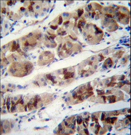 DDA1 Antibody - PCIA1 Antibody immunohistochemistry of formalin-fixed and paraffin-embedded human stomach tissue followed by peroxidase-conjugated secondary antibody and DAB staining.