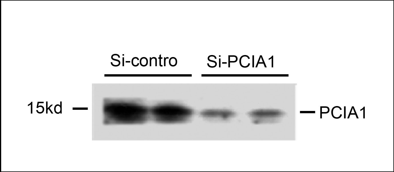 DDA1 Antibody - Western blot of extracts from 293T cells that were transfected with si-control or transfected si-PCIA1, using rabbit polyclonal PCIA1 Antibody.