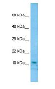 DDA1 Antibody - DDA1 antibody Western Blot of 721_B cell lysate. DDA1 is supported by BioGPS gene expression data to be expressed in 721_B.  This image was taken for the unconjugated form of this product. Other forms have not been tested.