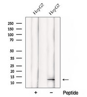 DDA1 Antibody - Western blot analysis of extracts of HepG2 cells using DDA1 antibody. The lane on the left was treated with blocking peptide.