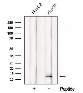 DDA1 Antibody - Western blot analysis of extracts of HepG2 cells using DDA1 antibody. The lane on the left was treated with blocking peptide.