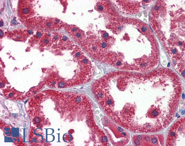 DDAH1 Antibody - Anti-DDAH1 antibody IHC of human kidney. Immunohistochemistry of formalin-fixed, paraffin-embedded tissue after heat-induced antigen retrieval. Antibody concentration 2.5 ug/ml.  This image was taken for the unconjugated form of this product. Other forms have not been tested.