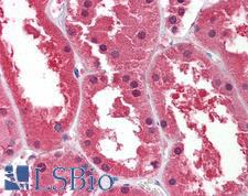 DDAH1 Antibody - Anti-DDAH1 antibody IHC of human kidney. Immunohistochemistry of formalin-fixed, paraffin-embedded tissue after heat-induced antigen retrieval. Antibody concentration 2.5 ug/ml.  This image was taken for the unconjugated form of this product. Other forms have not been tested.