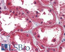 DDAH1 Antibody - Anti-DDAH1 antibody IHC of human kidney. Immunohistochemistry of formalin-fixed, paraffin-embedded tissue after heat-induced antigen retrieval. Antibody concentration 2.5 ug/ml.  This image was taken for the unconjugated form of this product. Other forms have not been tested.