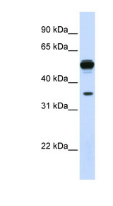DDAH1 Antibody - DDAH1 antibody Western blot of Fetal Liver lysate. This image was taken for the unconjugated form of this product. Other forms have not been tested.