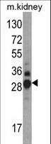 DDAH1 Antibody - Western blot of DDAH1 Antibody in mouse kidney tissue lysates (35 ug/lane). DDAH1 (arrow) was detected using the purified antibody.