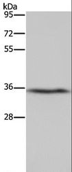 DDAH1 Antibody - Western blot analysis of Human fetal liver tissue, using DDAH1 Polyclonal Antibody at dilution of 1:400.