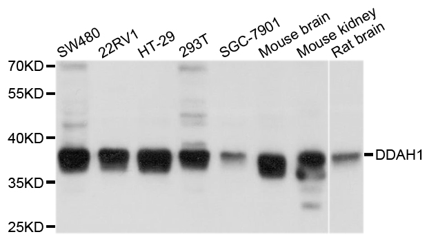 DDAH1 Antibody - Western blot analysis of extracts of various cell lines, using DDAH1 antibody at 1:1000 dilution. The secondary antibody used was an HRP Goat Anti-Rabbit IgG (H+L) at 1:10000 dilution. Lysates were loaded 25ug per lane and 3% nonfat dry milk in TBST was used for blocking. An ECL Kit was used for detection and the exposure time was 1s.