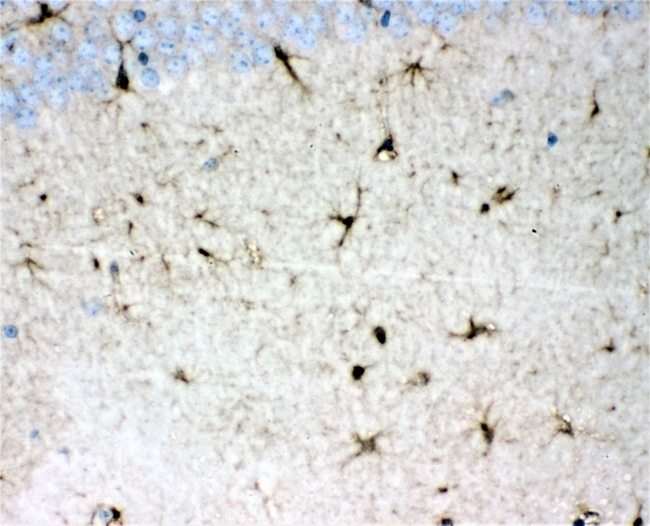 DDAH1 Antibody - IHC analysis of DDAH1 using anti-DDAH1 antibody. DDAH1 was detected in paraffin-embedded section of mouse brain tissues. Heat mediated antigen retrieval was performed in citrate buffer (pH6, epitope retrieval solution) for 20 mins. The tissue section was blocked with 10% goat serum. The tissue section was then incubated with 1µg/ml rabbit anti-DDAH1 Antibody overnight at 4°C. Biotinylated goat anti-rabbit IgG was used as secondary antibody and incubated for 30 minutes at 37°C. The tissue section was developed using Strepavidin-Biotin-Complex (SABC) with DAB as the chromogen.