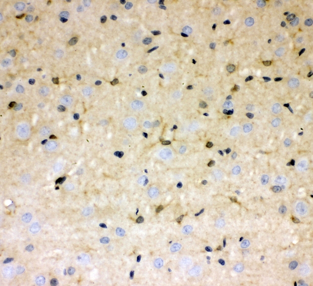 DDAH1 Antibody - IHC analysis of DDAH1 using anti-DDAH1 antibody. DDAH1 was detected in paraffin-embedded section of rat brain tissues. Heat mediated antigen retrieval was performed in citrate buffer (pH6, epitope retrieval solution) for 20 mins. The tissue section was blocked with 10% goat serum. The tissue section was then incubated with 1µg/ml rabbit anti-DDAH1 Antibody overnight at 4°C. Biotinylated goat anti-rabbit IgG was used as secondary antibody and incubated for 30 minutes at 37°C. The tissue section was developed using Strepavidin-Biotin-Complex (SABC) with DAB as the chromogen.
