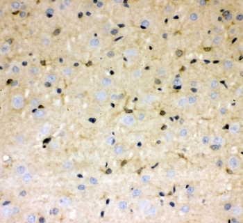 DDAH1 Antibody - IHC staining of FFPE rat brain with DDAH1 antibody at 1ug/ml. HIER: boil tissue sections in pH6, 10mM citrate buffer, for 10-20 min followed by cooling at RT for 20 min.