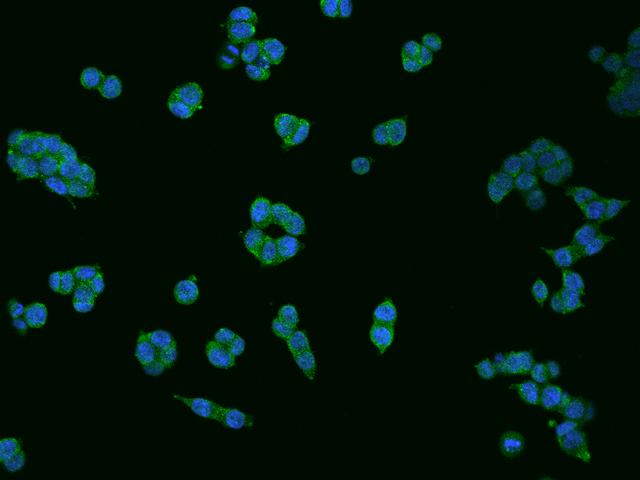 DDAH1 Antibody - Immunofluorescence staining of DDAH1 in HCT116 cells. Cells were fixed with 4% PFA, permeabilzed with 0.1% Triton X-100 in PBS, blocked with 10% serum, and incubated with rabbit anti-Human DDAH1 polyclonal antibody (dilution ratio 1:200) at 4°C overnight. Then cells were stained with the Alexa Fluor 488-conjugated Goat Anti-rabbit IgG secondary antibody (green) and counterstained with DAPI (blue). Positive staining was localized to Cytoplasm.