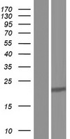 DDAH1 Protein - Western validation with an anti-DDK antibody * L: Control HEK293 lysate R: Over-expression lysate