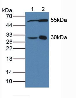 DDAH2 Antibody - Western Blot; Sample: Lane1: Human MCF7 Cells; Lane2: Porcine Brain Tissue.