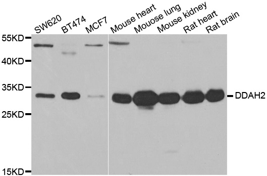 DDAH2 Antibody - Western blot analysis of extracts of various cell lines.