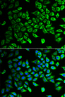 DDAH2 Antibody - Immunofluorescence analysis of HeLa cells.
