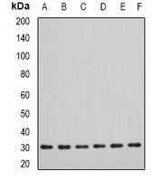 DDAH2 Antibody - Western blot analysis of DDAH2 expression in SW620 (A); MCF7 (B); mouse lung (C); mouse kidney (D); rat heart (E); rat brain (F) whole cell lysates.