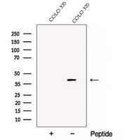 DDAH2 Antibody - Western blot analysis of extracts of COLO 320 cells using DDAH2 antibody. The lane on the left was treated with blocking peptide.
