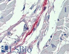 DDAH2 Antibody - Anti-DDAH2 antibody IHC of human heart. Immunohistochemistry of formalin-fixed, paraffin-embedded tissue after heat-induced antigen retrieval. Antibody concentration 5 ug/ml.  This image was taken for the unconjugated form of this product. Other forms have not been tested.