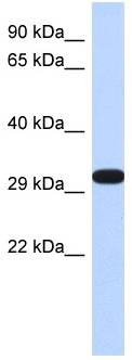 DDAH2 Antibody - Western blot of Fetal Brain lysates.  This image was taken for the unconjugated form of this product. Other forms have not been tested.