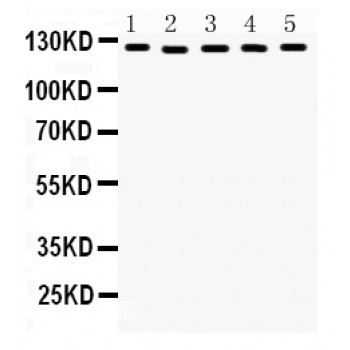 DDB1 Antibody - DDB1 antibody Western blot. All lanes: Anti DDB1 at 0.5 ug/ml. Lane 1: Rat Brain Tissue Lysate at 50 ug. Lane 2: Rat Liver Tissue Lysate at 50 ug. Lane 3: Mouse Ovary Tissue Lysate at 50 ug. Lane 4: Mouse Testis Tissue Lysate at 50 ug. Lane 5: MCF-7 Whole Cell Lysate at 40 ug. Predicted band size: 127 kD. Observed band size: 127 kD.