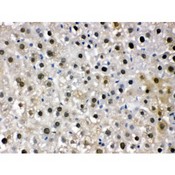 DDB1 Antibody - DDB1 antibody IHC-paraffin. IHC(P): Mouse Liver Tissue.