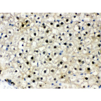DDB1 Antibody - DDB1 antibody IHC-paraffin. IHC(P): Rat Liver Tissue.