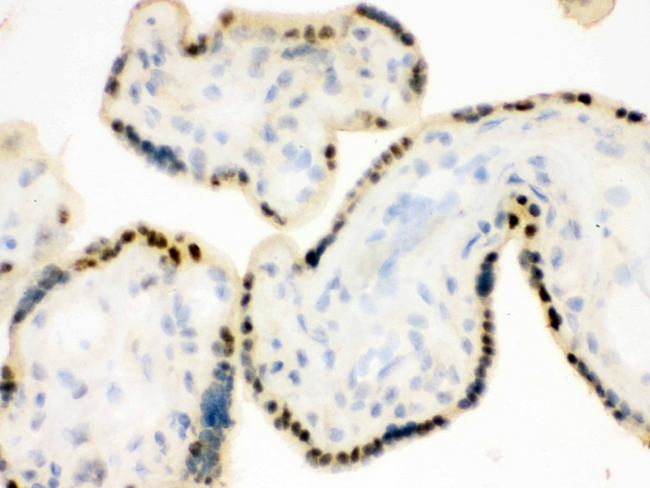 DDB1 Antibody - IHC analysis of DDB1 using anti-DDB1 antibody. DDB1 was detected in frozen section of human placenta tissue . Heat mediated antigen retrieval was performed in citrate buffer (pH6, epitope retrieval solution) for 20 mins. The tissue section was blocked with 10% goat serum. The tissue section was then incubated with 1µg/ml rabbit anti-DDB1 Antibody overnight at 4°C. Biotinylated goat anti-rabbit IgG was used as secondary antibody and incubated for 30 minutes at 37°C. The tissue section was developed using Strepavidin-Biotin-Complex (SABC) with DAB as the chromogen.