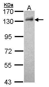 DDB1 Antibody - Sample (30 ug of whole cell lysate). A: Hep G2 . 7.5% SDS PAGE. DDB1 antibody diluted at 1:1000.