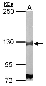 DDB1 Antibody - Sample (50 ug of whole cell lysate). A: Mouse brain. 5% SDS PAGE. DDB1 antibody diluted at 1:5000.