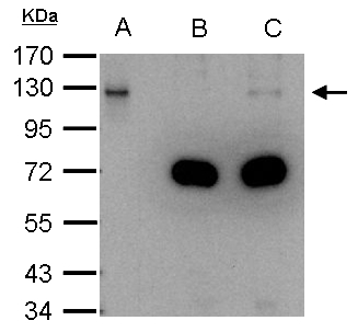DDB1 Antibody - DDB1 antibody immunoprecipitates DDB1 protein in IP experiments. IP Sample:1000 ug HeLa whole cell lysate/extract A. 40 ug HeLa whole cell lysate/extract B. Control with 2.5 ug of preimmune rabbit IgG C. Immunoprecipitation of DDB1 protein by 2.5 ug of DDB1 antibody 7.5% SDS-PAGE The immunoprecipitated DDB1 protein was detected by DDB1 antibody diluted at 1:1000. EasyBlot anti-rabbit IgG (anti-rabbit IgG (HRP) -01) was used as a secondary reagent.