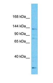 DDB1 Antibody - Western blot of DDB1 Antibody with human MCF7 Whole Cell lysate.  This image was taken for the unconjugated form of this product. Other forms have not been tested.
