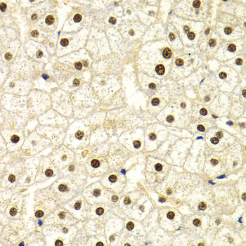 DDB1 Antibody - Immunohistochemistry of paraffin-embedded human liver injury tissue.