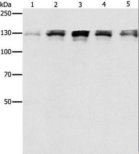 DDB1 Antibody - Western blot analysis of Human fetal small intestine, liver cancer and Lymphoma Lymphoma, 293T and A549 cell, using DDB1 Polyclonal Antibody at dilution of 1:500.