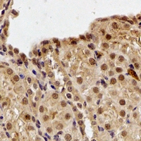 DDB1 Antibody - Immunohistochemical analysis of DDB1 staining in human kidney formalin fixed paraffin embedded tissue section. The section was pre-treated using heat mediated antigen retrieval with sodium citrate buffer (pH 6.0). The section was then incubated with the antibody at room temperature and detected using an HRP conjugated compact polymer system. DAB was used as the chromogen. The section was then counterstained with hematoxylin and mounted with DPX.