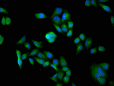 DDB1 Antibody - Immunofluorescence staining of Hela cells with DDB1 Antibody at 1:100, counter-stained with DAPI. The cells were fixed in 4% formaldehyde, permeabilized using 0.2% Triton X-100 and blocked in 10% normal Goat Serum. The cells were then incubated with the antibody overnight at 4°C. The secondary antibody was Alexa Fluor 488-congugated AffiniPure Goat Anti-Rabbit IgG(H+L).