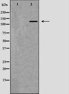 DDB1 Antibody - Western blot analysis of HeLa whole cells lysates using DDB1 antibody. The lane on the left is treated with the antigen-specific peptide.