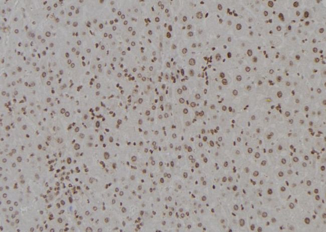 DDB1 Antibody - 1:100 staining mouse liver tissue by IHC-P. The sample was formaldehyde fixed and a heat mediated antigen retrieval step in citrate buffer was performed. The sample was then blocked and incubated with the antibody for 1.5 hours at 22°C. An HRP conjugated goat anti-rabbit antibody was used as the secondary.