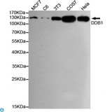 DDB1 Antibody - Western blot detection of DDB1 in Hela, MCF7, COS7, C6 and 3T3 cell lysates using DDB1 mouse mAb (1:1000 diluted) , with Super ECL. Predicted band size: 127KDa. Observed band size: 127KDa.