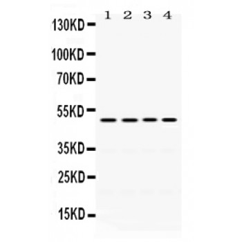 DDB2 Antibody - DDB2 antibody Western blot. All lanes: Anti DDB2 at 0.5 ug/ml. Lane 1: A431 Whole Cell Lysate at 40 ug. Lane 2: SW620 Whole Cell Lysate at 40 ug. Lane 3: HELA Whole Cell Lysate at 40 ug. Lane 4: JURKAT Whole Cell Lysate at 40 ug. Predicted band size: 48 kD. Observed band size: 48 kD.