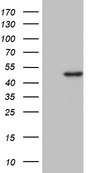 DDB2 Antibody - HEK293T cells were transfected with the pCMV6-ENTRY control. (Left lane) or pCMV6-ENTRY DDB2. (Right lane) cDNA for 48 hrs and lysed. Equivalent amounts of cell lysates. (5 ug per lane) were separated by SDS-PAGE and immunoblotted with anti-DDB2. (1:500)