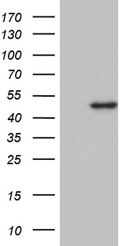 DDB2 Antibody - HEK293T cells were transfected with the pCMV6-ENTRY control. (Left lane) or pCMV6-ENTRY DDB2. (Right lane) cDNA for 48 hrs and lysed