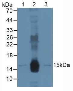 DDB2 Antibody - Western Blot; Sample: Lane1: Human A431 Cells; Lane2: Human Raji Cells; Lane3: Mouse Skin Tissue.