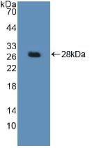 DDB2 Antibody - Western Blot; Sample: Recombinant DDB2, Human.