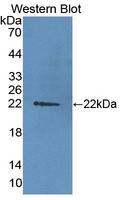 DDB2 Antibody - Western blot of DDB2 antibody.